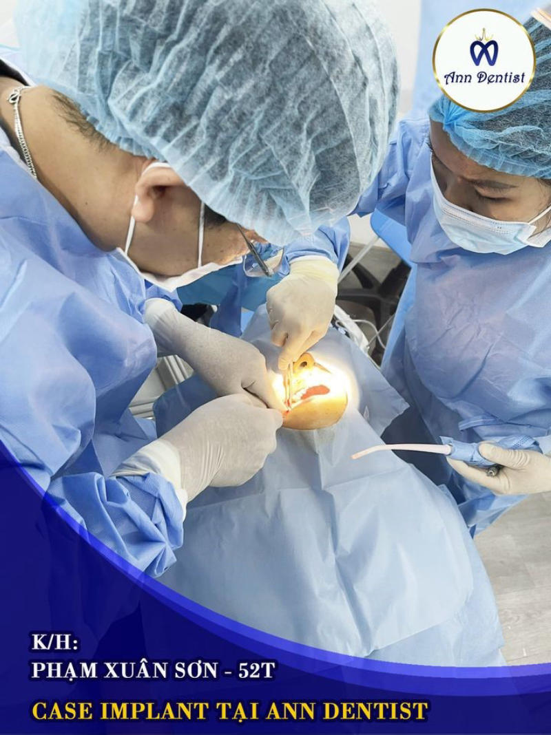 Feeback khách hàng sau khi trồng răng Implant tại Ann Dentist