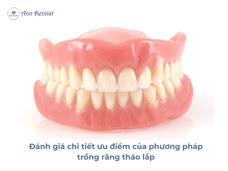 Đánh giá chi tiết ưu điểm của phương pháp trồng răng tháo lắp