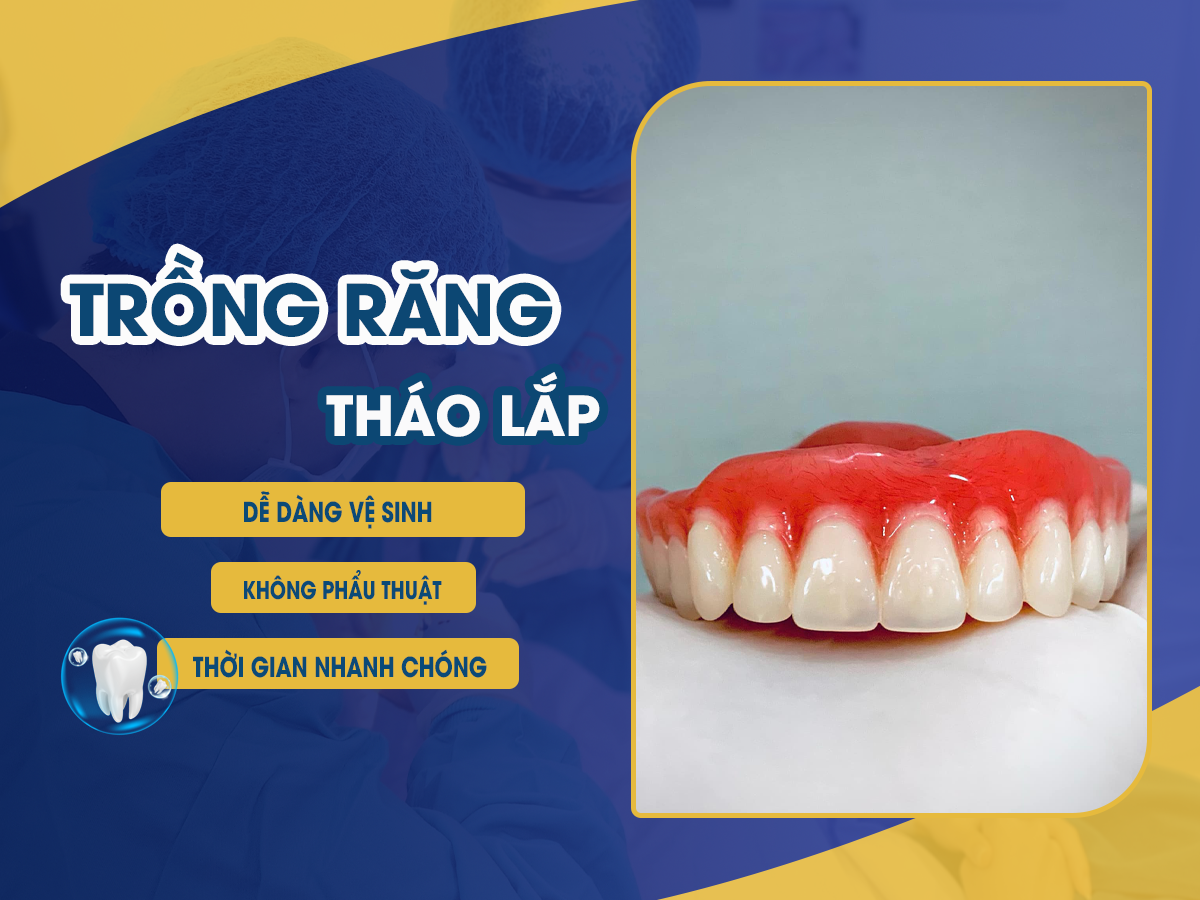 Dịch Vụ Trồng Răng Tháo Lắp Bền Đẹp, Thẩm Mỹ