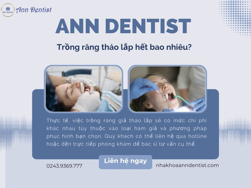 Trồng răng tháo lắp hết bao nhiêu?