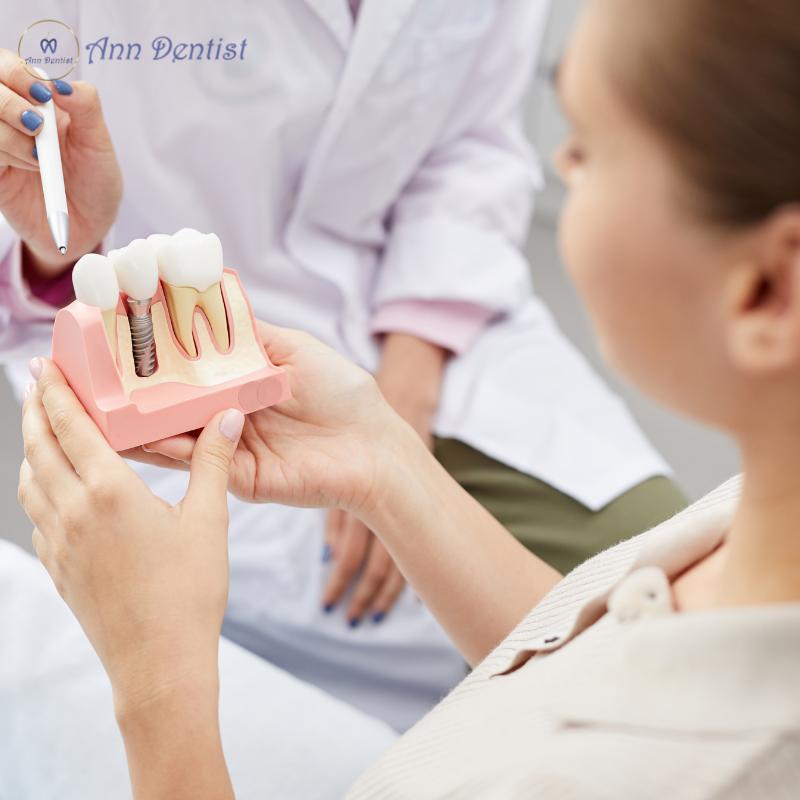 5 lý do tại sao Ann Dentist là địa chỉ trồng răng Implant hàng đầu