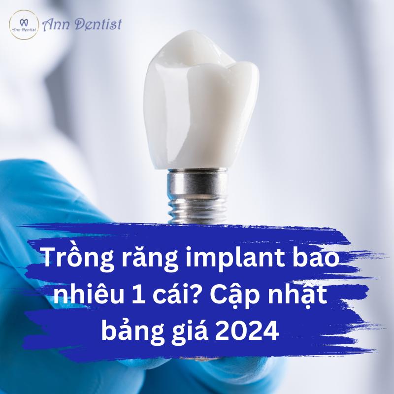 Trồng răng implant bao nhiêu 1 cái? Cập nhật bảng giá 2024