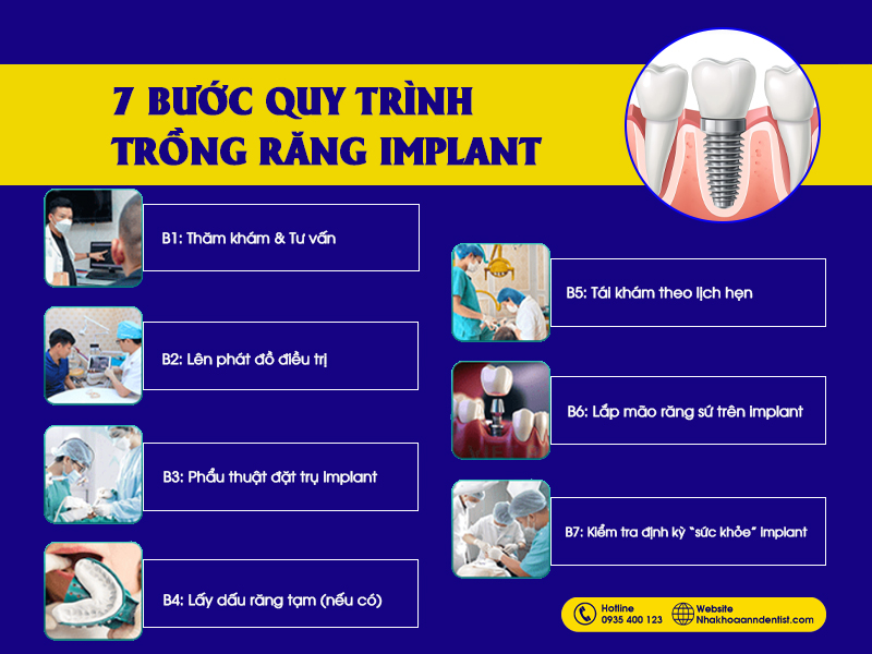 Quy trình trồng răng implant tại Ann Dentist.