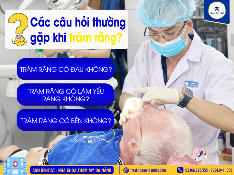 Các câu hỏi thường gặp khi trám răng