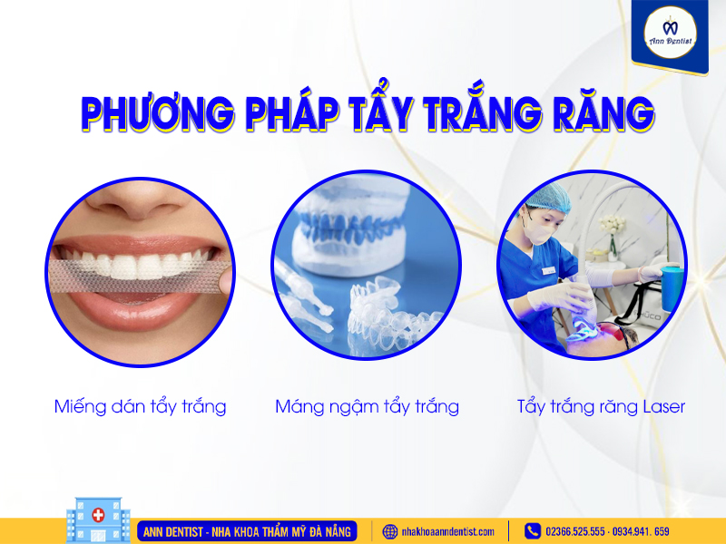 Các phương pháp tẩy trắng răng hiện nay.