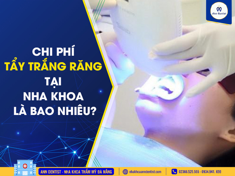 Chi phí tẩy trắng răng tại nha khoa là bao nhiêu.