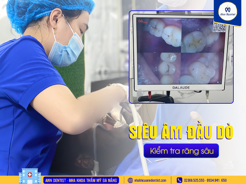 Kiểm tra đầu dò sau khi lấy sạch vôi răng giúp phát hiện sớm răng sâu.