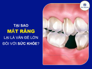 Mất răng ảnh hưởng rất lớn đến sức khỏe răng miệng - Ann Dentist