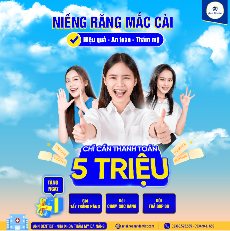 Tại Ann Dentist chi phí niềng linh hoạt - Trả góp không lãi suất.