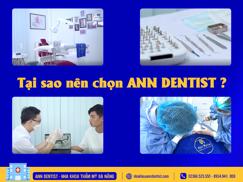 Tại sao nên chọn Ann Dentist để trồng răng
