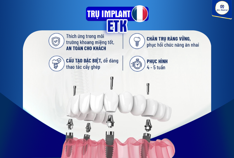 Lợi ích khi trồng trụ implant ETK.