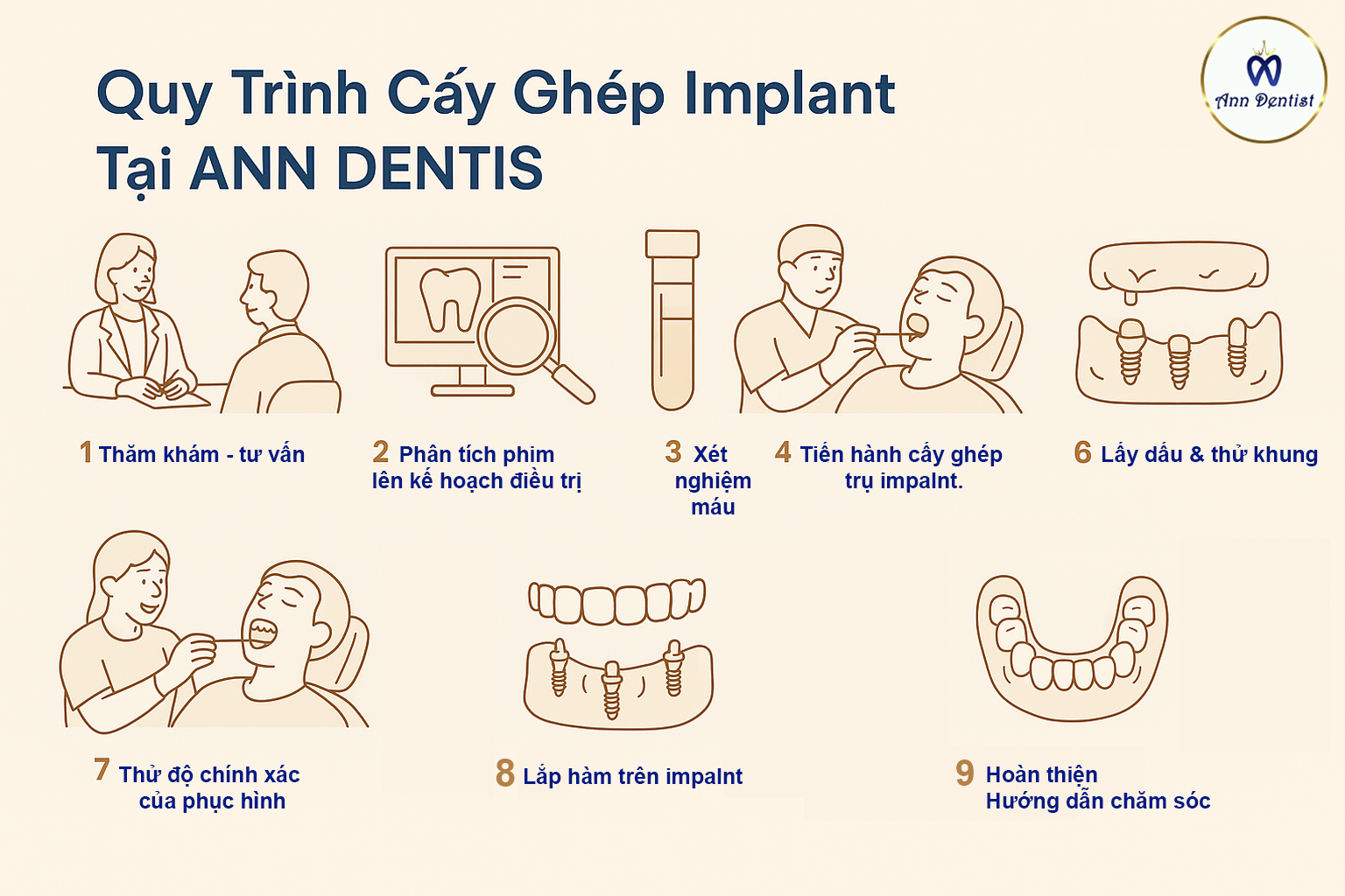 Quy trình cấy ghép implant tại Ann Dentist.