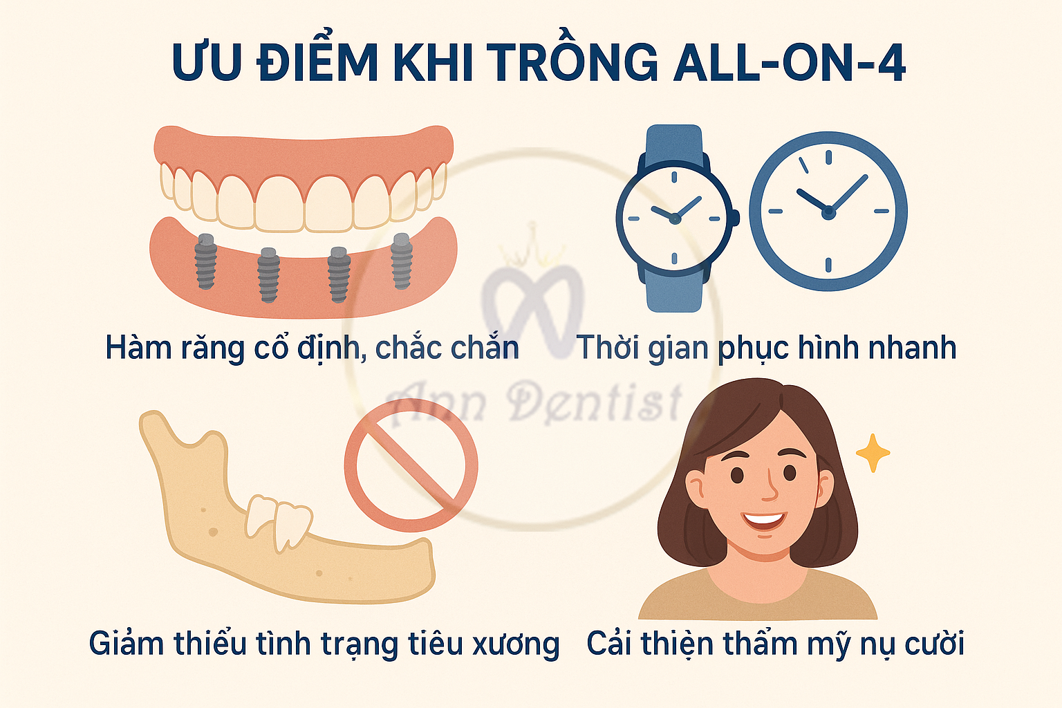 Ưu điểm khi trồng răng Implant All-on-4 - Ann Dentist.