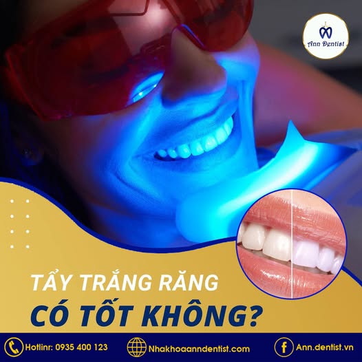 Tảy trắng răng có hại men răng không?