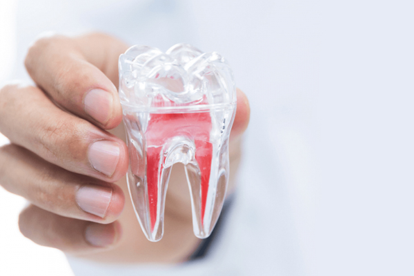 Bảo tồn tủy răng là gì?