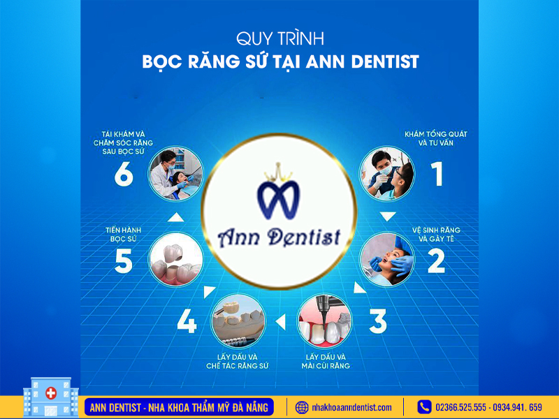 Quy trình bọc răng sứ tại Ann Dentist.