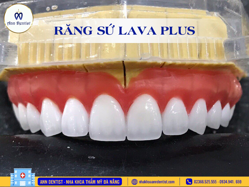 Răng sứ Lava Plus có độ trong mờ tự nhiên giống men răng thật.