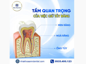 Tầm quan trọng của việc giữ tủy răng.