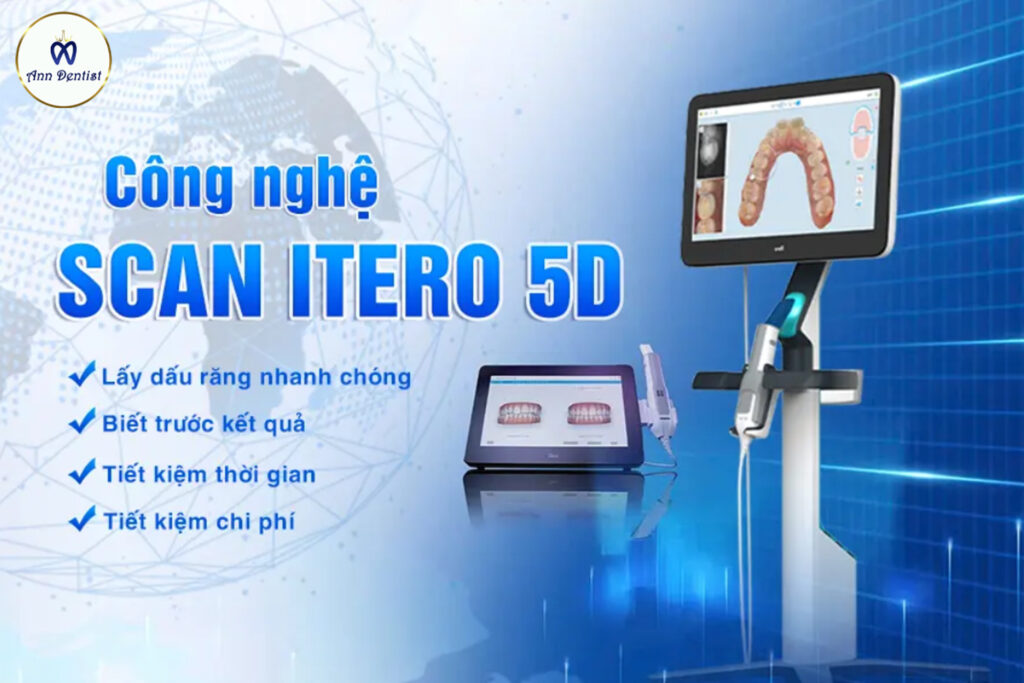Công nghệ Scan Răng 5D biết trước kết quả tại Ann Dentist.
