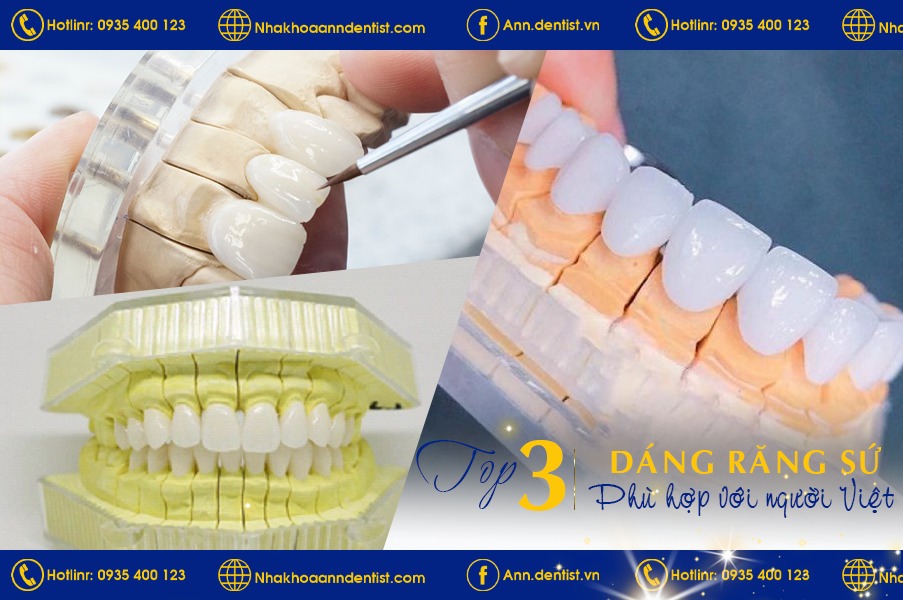 3 Dáng răng sứ phù hợp với người Việt