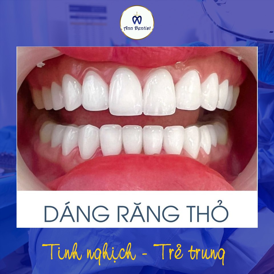 Dáng răng thỏ (Rabbit Style) – Răng sứ phong thủy tại Ann Dentist.