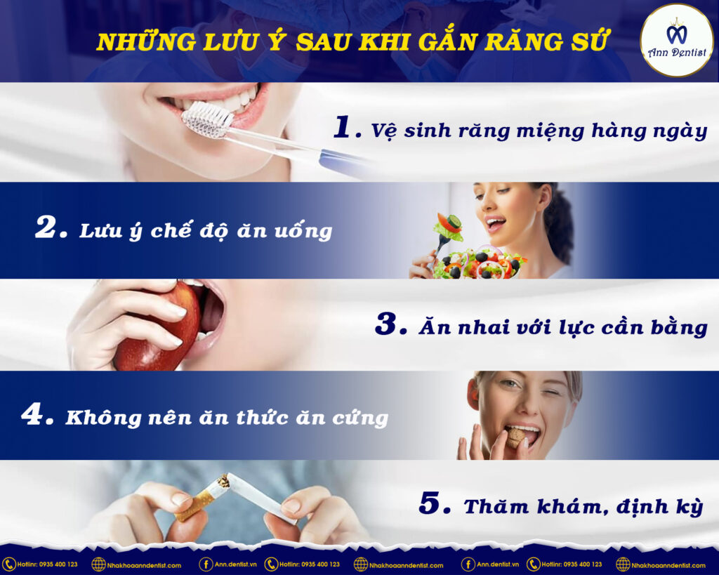 Những lưu ý sau khi bọc răng sứ.