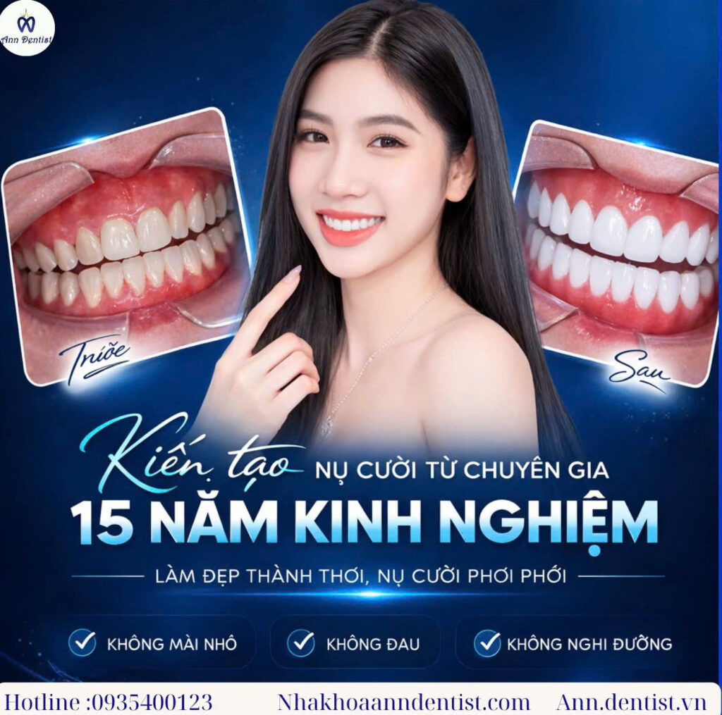 Răng sứ thẩm mỹ