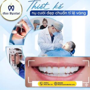 Thiết kế nụ cười đẹp chuẩn tỉ lệ vàng khi bọc răng sứ thẩm mỹ.