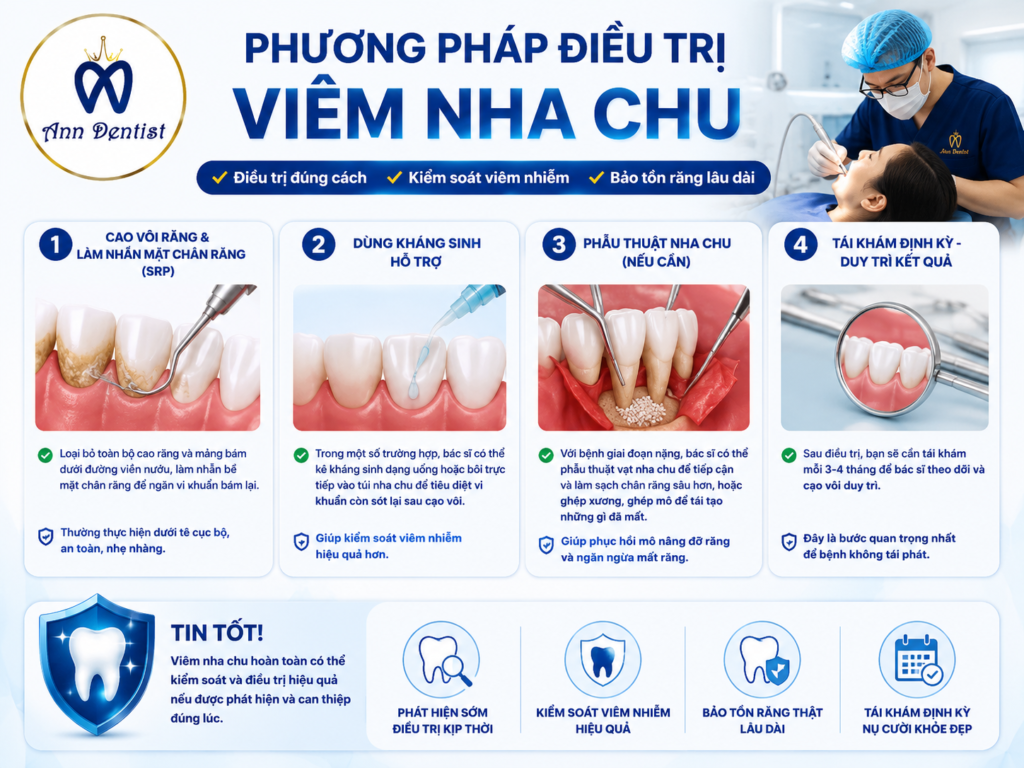 phương pháp điều trị viêm nha chu tại Ann Dentist với các bước cạo vôi răng, dùng kháng sinh hỗ trợ, phẫu thuật nha chu và tái khám định kỳ