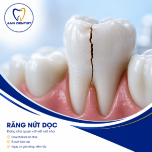 Răng nứt dọc. Đau nhói khi ăn nhai? Ê buốt kéo dài? Đó có thể là dấu hiệu của răng nứt dọc. Đừng chờ đến khi vết nứt lan rộng gây viêm tủy hoặc gãy răng.