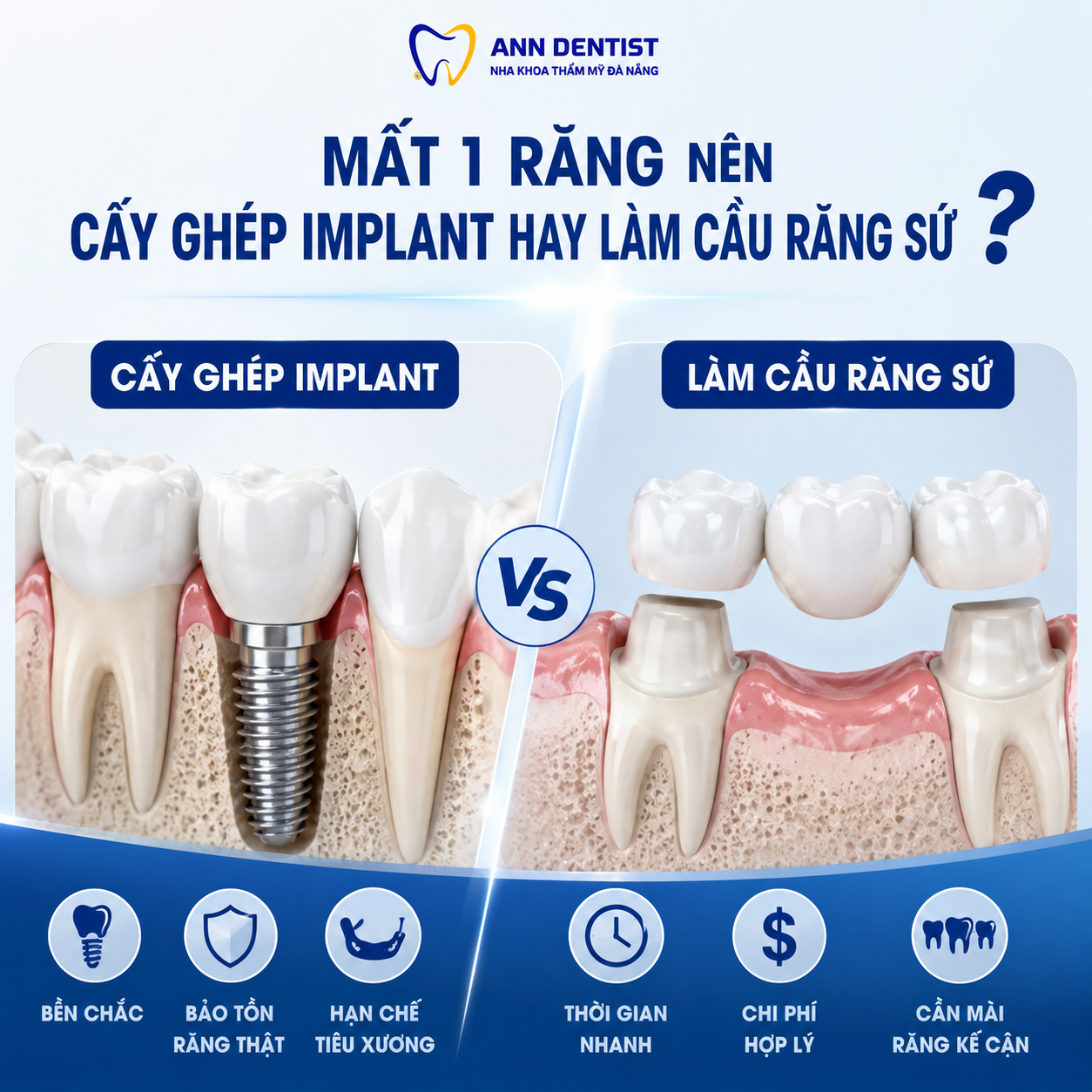 Mất 1 răng nên cấy ghép implant hay làm cầu răng sứ