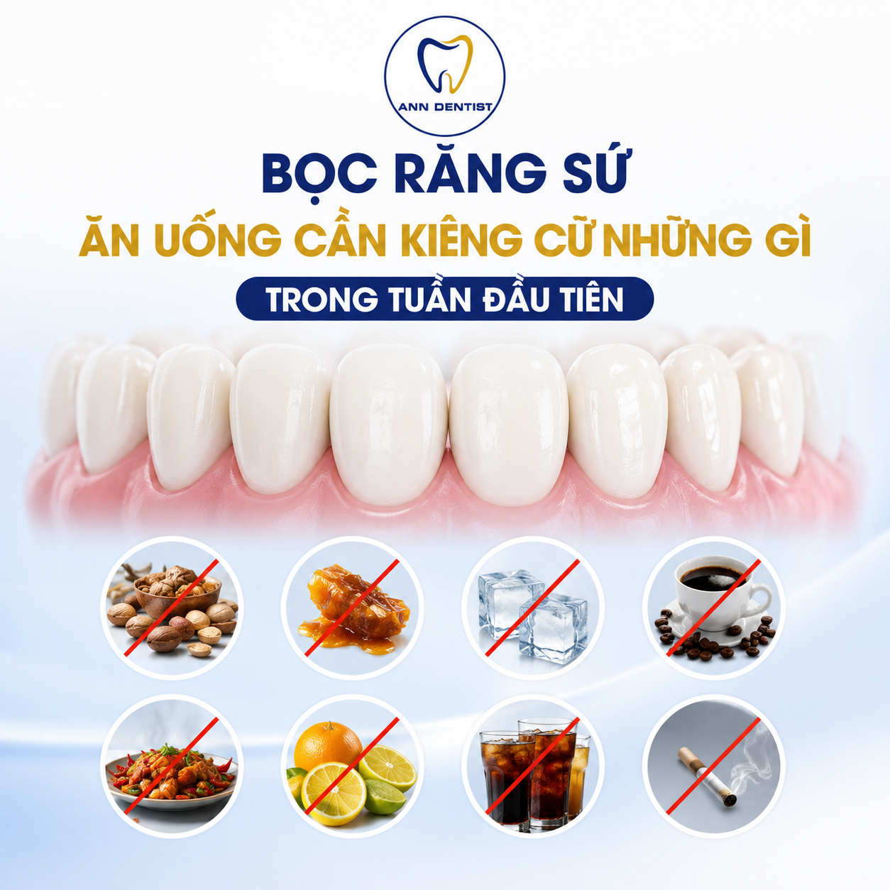 bọc răng sứ cần kiêng ăn uống những gì?