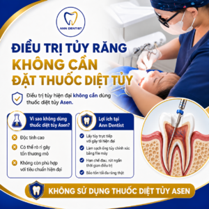Điều trị tủy không đặt thuốc diệt tủy AS