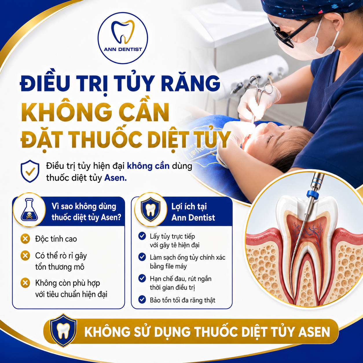 Điều trị tủy không đặt thuốc diệt tủy AS