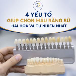 4 yếu tố chọn màu răng sứ đẹp và tự nhiên