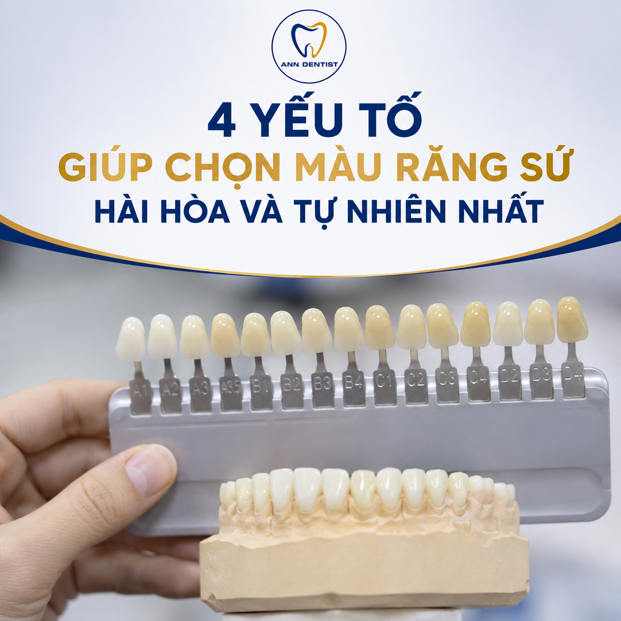 4 yếu tố chọn màu răng sứ đẹp và tự nhiên