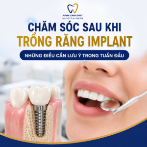 trồng răng implant là đầu tư cho sức khỏe lâu dài