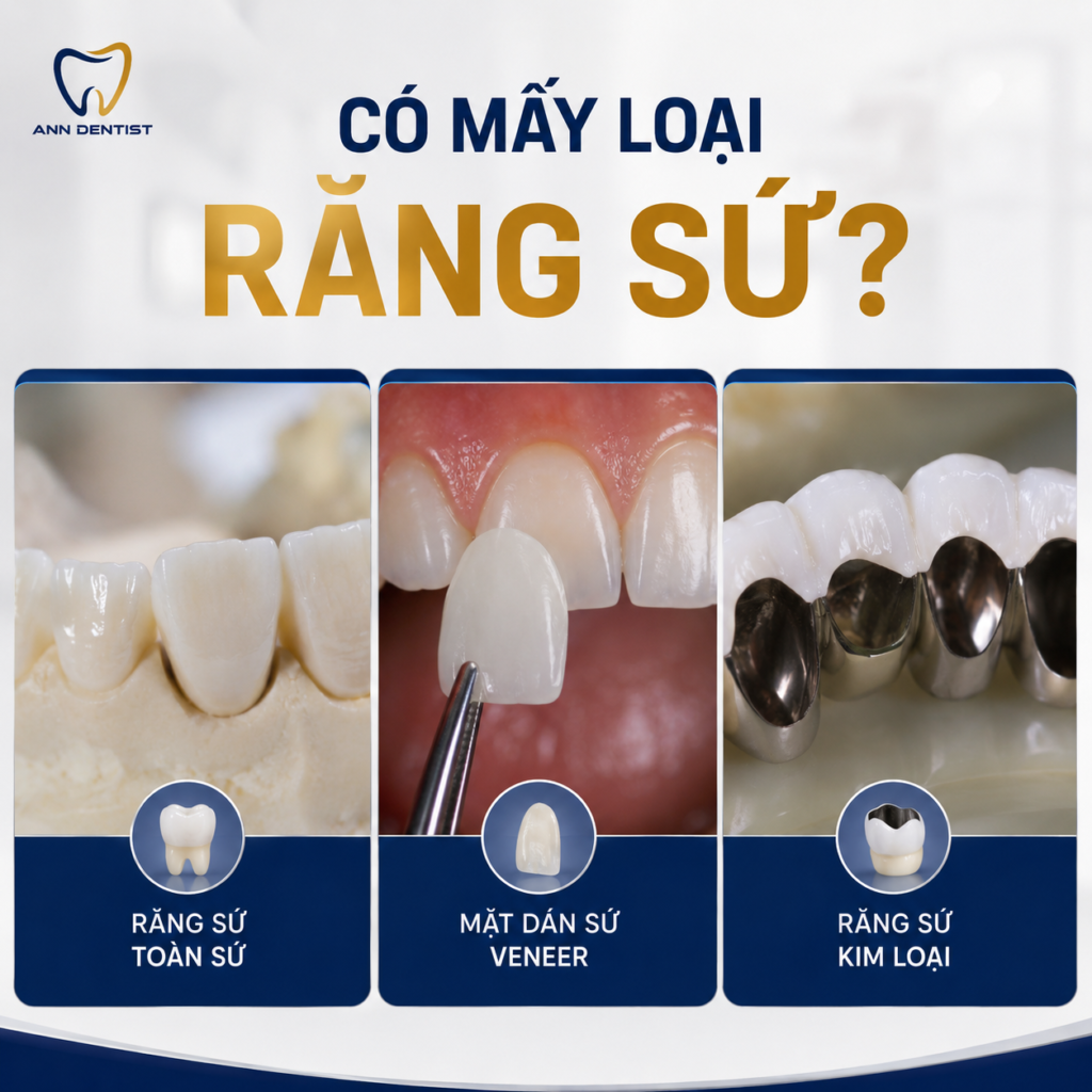 có những loại răng sứ nào