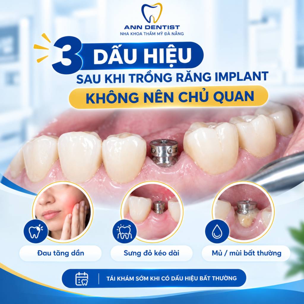 dấu hiệu trồng răng implant cần lưu ý
