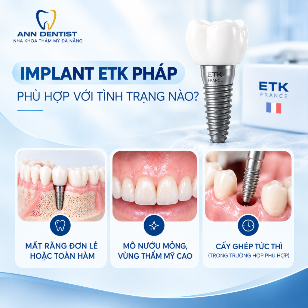 Implant ETK Pháp